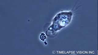 Bacterial phagocytosis by neutrophils -好中球による細菌の貪食-