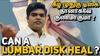 Sciatica - Can a Lumbar Disk Heal?  கீழ் முதுகு டிஸ்க் தானாகவே குணமாகுமா ?  Dr Pritem