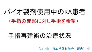 バイオ製剤使用中RA患者の手指変形に対する手術（2018年日本手外科学会報告）＃関節リウマチ　＃生物学的製剤　＃手指変形　＃手術