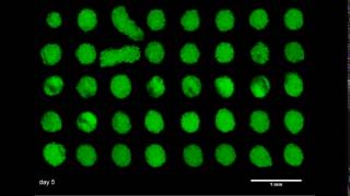 3D printed osteosarcoma spheroids expanding in liquid-like solid 3D growth media