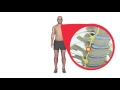Post traumatic stress disorder (PTSD) and Stellate ganglion block Post traumatic stress disorder (PTSD) and Stellate ganglion block