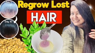 30 Days *Winter Hair Growth* Transformation : Fix Bald Patches Receding Hairline \u0026 Regrow Lost Hair💕