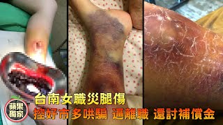 台南女職災腿傷　控好市多哄騙逼離職還討補償金 #獨家 | 台灣新聞 Taiwan 蘋果新聞網