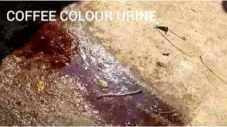 Coffee colour urine / Babesiosis / Cow