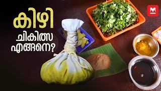 കിഴി ചികിത്സ എങ്ങനെ? | What is Ayurvedic 'Kizhi' treatment