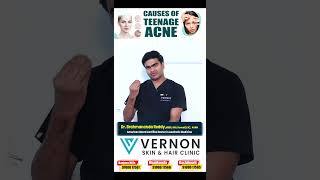 యుక్త వయసు-మొటిమలు | Causes of Teenage ACNE in Telugu | Skin Care Tips | Vernon Skin \u0026 Hair Clinic