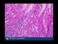 Histology of the Stomach - PathologyNOW