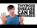 7 Reversible Causes of Hypothyroidism