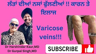 varicose veins causes , treatment. ਲੱਤਾਂ ਦੀਆਂ ਫੁੱਲੀਆਂ ਹੋਈਆਂ ਨਸਾਂ ! ਕੀ ਕਾਰਣ ਤੇ ਕੀ ਇਲਾਜ !! (109)