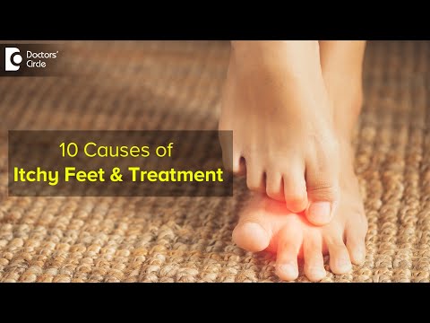 Why does my foot itch when its swollen?