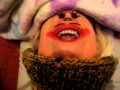 Lady Gaga Bad Romance Chin