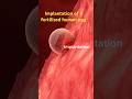 1st week of life. Implantation of a Fertilized Egg. #shortvideo #baby #pregnant August 27, 2024