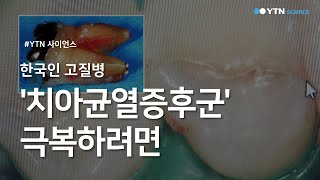 한국인 고질병 '치아균열증후군' 극복하려면 / YTN 사이언스