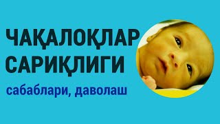 Чақалоқлар сариқлиги: сабаблари, даволаш