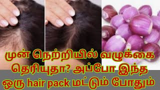 முன் நெற்றி வழுக்கையா இருக்கா?/ Baldness hair growth in tamil/ baldness hair growth tips in tamil