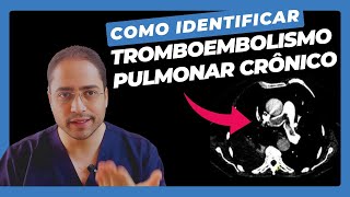 Tromboembolismo pulmonar crônico, como identificar?