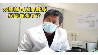 骨癌复发，肿瘤疯长，家属急哭！恶性肿瘤复发，还能治吗？