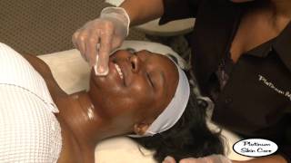 Jessner's Peel from Platinum Skin Care