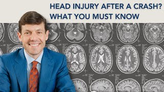 Concussions After Car Accidents: What You Need to Know | Brain Injury Lawyer Kenneth Berger