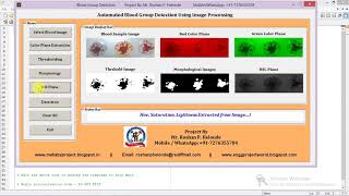 Matlab Code for Blood Group Determination Using Image Processing