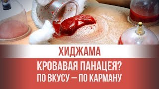 Хиджама: Омолаживание или бизнес на крови? По вкусу – по карману