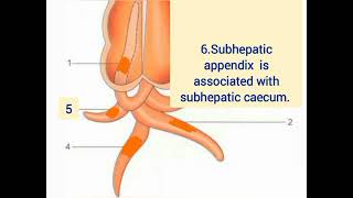 normal positions of the appendix