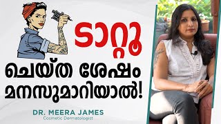 ടാറ്റൂ ചെയ്ത ശേഷം മനസ്സ് മാറിയാൽ! Dr Meera James