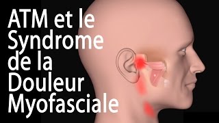 L’ATM et le Syndrome de la Douleur Myofasciale, Animation.