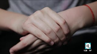 Houston dermatologist explains how to treat dry or cracked hands | HOUSTON LIFE | KPRC 2