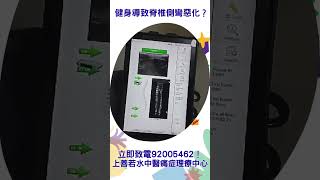 健身導致脊椎側彎惡化、動作受限🚫？立即致電92005462查詢！客人陳先生細個已患有脊椎側彎，因為無特別去治療，直到佢最近加強做gym 重訓時發現身體歪斜、動作力量不均，更有下腰痺痛情況出現！