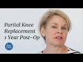 MAKOPlasty partial knee replacement patient story - 1 year post op