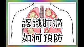 十大癌症死因之冠....認識肺癌及如何預防 （肺癌1/2）