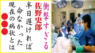 佐野史郎、今現在が衝撃的すぎる！