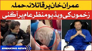 Imran Khan Injury Wounds Exclusive Footage | Imran Khan Kay Zakhmon Ki Video Viral | Breaking News