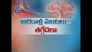 అరికాళ్లలో మంటలా? | సుఖీభవ | 25 మార్చి 2019 | ఈటీవీ తెలంగాణ