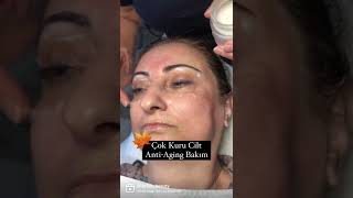 Çok Kuru Cilt Anti-Aging Bakım