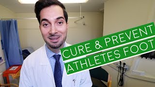 Athlete's Foot | How To Cure Athlete's Foot | Athlete's Foot Cream (2024)