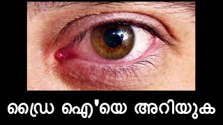 ഡ്രൈ ഐ'യെ അറിയുക  |  DRY EYE  | വരണ്ട  കണ്ണ്