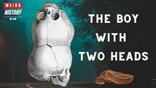 The Boy With Two Heads | Weird History Ep. #9