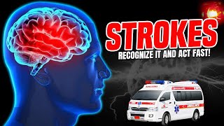 Strokes in EMS || Recognition is key!