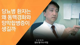 당뇨병 환자는 왜 동맥경화와 망막합병증이 생길까 - (20120609_416회 방송)_눈이 안 보여요 - 망막질환