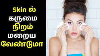 Skin ல் கருமை நிறம் மறைய வேண்டுமா இதை யூஸ் பண்ணுங்க | Tamil Beauty Tips