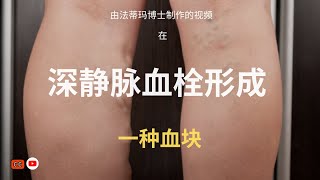 深静脉血栓的理解 (Deep Vein Thrombosis)