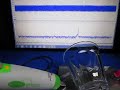 表面を伝搬する超音波（基礎実験）　supersonic wave experiment