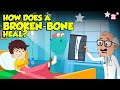 How Bone Fractures Heal? | How Does a Broken Bone Heal? | Process of Bone Healing | Dr. Binocs Show
