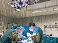 De Quervain Release (Live Surgery)