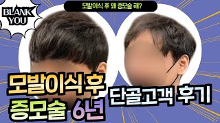 모발이식 후 증모술 6년 단골고객 후기는?