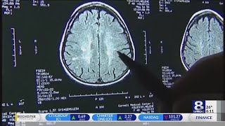 URMC taking part in repetitive head hits research, along with other universities