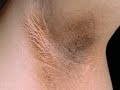 HOW TO LIGHTEN DARK UNDERARMS??? #TMITUESDAYS HOW TO LIGHTEN DARK UNDERARMS??? #TMITUESDAYS