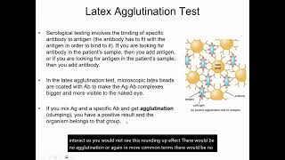 Latex Agglutination: Determining Lancefield Groups